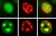 Gesunde Hefezellen (o.) u. kranke Hefezellen mit Ansammlungen von α-Synuklein-Aggregaten (grün). Mitochondrien (rot) liegen in kranken Z. stark fragmentiert vor, wenn der protektive Faktor  Yhb1 fehlt Quelle: Braus / CNMPB