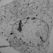 A Fibroblast Undergoing Ferroptosis. Source: Helmholtz Zentrum München