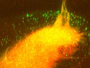 Transplant of human neurons in the hippocampus of a mouse: the surrounding nerve cells in the mouse brain have connected to engrafted neurons.  © Photo: Dr. Jonas Doerr