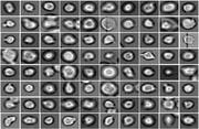 What are they going to be? Hematopoietic stem cells under the microscope: New methods are helping the Helmholtz scientists to predict how they will develop. Source: Helmholtz Zentrum München