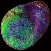 The novel organoid “fusion” technique is a new method to combine different brain tissues in a dish to observe complex interactions, such as cell migration and axon growth, between different developing brain regions.  Copyright: (c)IMBA