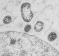 This is a view of a modified lymphocytic choriomeningitis virus (LCMV). © UNIGE / Doron Merkler