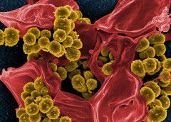 Methicillin-resistant Staphylococcus aureus (MRSA) (mustard-coloured) engulfed by a red coloured white blood cells (neutrophil granulocyte). National Institute of Allergy and Infectious Diseases (NIAID)