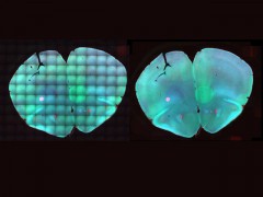 Mosaic image of a mouse brain slice improved by the software BaSiC. Image: Tingying Peng / TUM/HMGU
