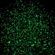 Scientists at the University of Bonn have found a way to specifically mark multipotent stromal cells. These cells therefore light up green in the microscope image. (c) Martin Breitbach/Uni Bonn