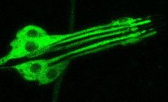 Mechanoreceptors of the drosophila larva. Photo: University of Göttingen