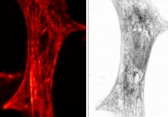 STED image (left) and x-ray imaging (right) of the same cardiac tissue cell from a rat. University of Goettingen