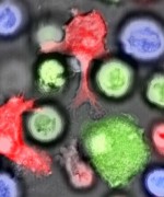 Natural killer cells (red) attack normal leukemia cells (green) but not leukemia stem cells (blue). Image: University of Basel, Department of Biomedicine, Christoph Schürch
