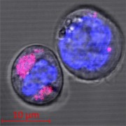 Two CD34+ stem cells containing carbon nanoparticles (coloured magenta); the cell nuclei can be seen in blue. The researchers found that the nanoparticles are encapsulated in the cell lysosomes. HHU / Stefan Fasbender
