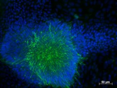 Fluorescence microscopy of induced pluripotent stem cells of a healthy blood donor differentiated into early ectoderm. Source: Paul-Ehrlich-Institut