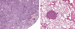 A lung tumor that expresses USP28 (left). On the right, however, tumors are shown in which USP28 has been "cut out" using the gene editing tool CRISPR/Cas9 – they are significantly smaller.  (Images: Markus Diefenbacher)