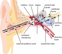 Figure 1: The ear is a portal of entry for nanoparticles via the external auditory canal. The connection of ear to inner ear offers an entrance to the most central parts for the particles. Nanoparticles go through the tympanic membrane to enter via the tympanic cavity all other parts of the inner ear and can even delocalize via the vestibular nerve, the cochlear nerve and the blood to the entire body, especially the brain. The particles can be from lead oxide, lead acetate and lead acetate coated solarium dioxide nanoparticles.